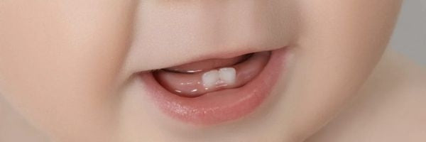 Teeth